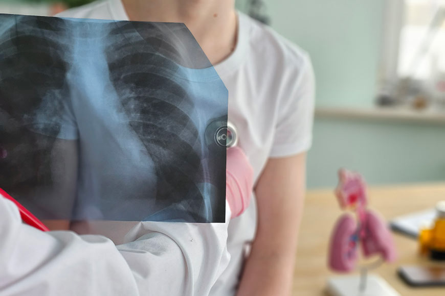 Photo of a doctor holding a lung x-ray while listening to a patient's lungs with a stethoscope